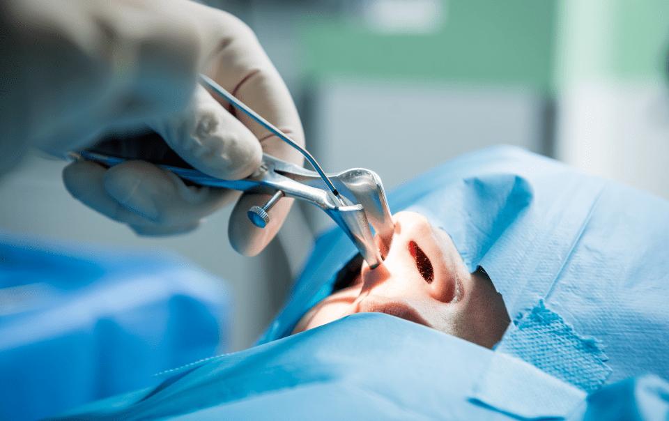 Assisted nasal surgery being performed with surgical tools on a patient.